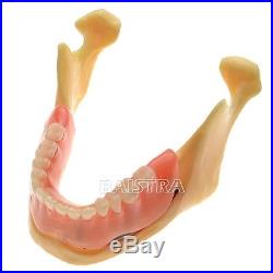 GER Dental Implant Teeth Model Lower Jaw for Study & Teach ZYR-2014 FREE SHIP